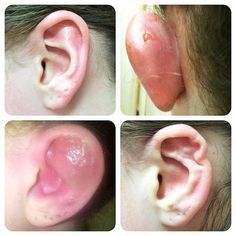 Příklady nepovedeného propíchnutí ucha